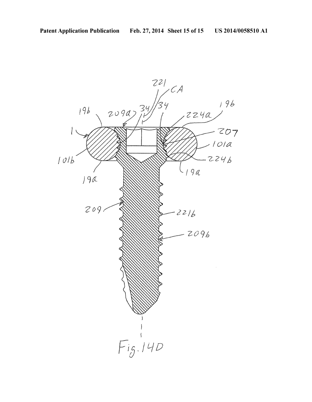 BONE IMPLANT - diagram, schematic, and image 16