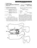 Expandable Fusion Device and Method of Installation Thereof diagram and image