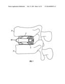 Expandable Fusion Device and Method of Installation Thereof diagram and image