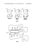 Expandable Fusion Device and Method of Installation Thereof diagram and image