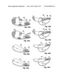 Rubber or soft plastic fishing spoon lure diagram and image