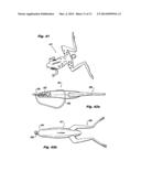 Rubber or soft plastic fishing spoon lure diagram and image