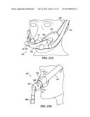 PATIENT INTERFACE DEVICE diagram and image