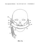 PATIENT INTERFACE DEVICE diagram and image