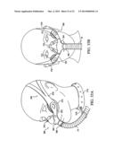 PATIENT INTERFACE DEVICE diagram and image