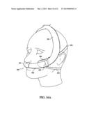 PATIENT INTERFACE DEVICE diagram and image