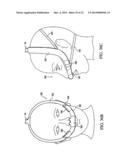 PATIENT INTERFACE DEVICE diagram and image