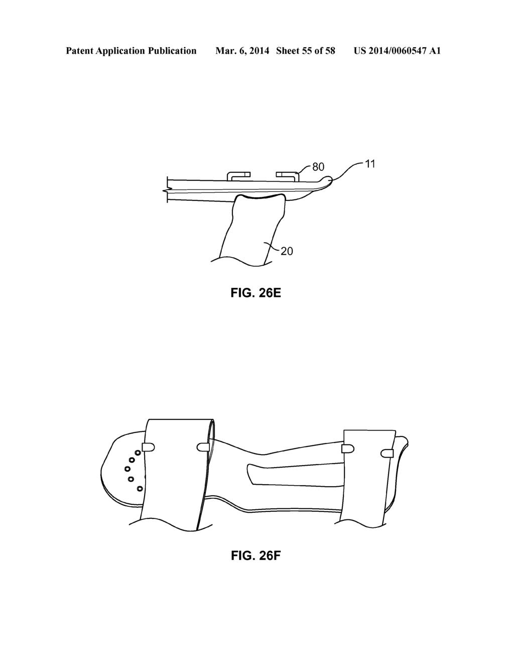 INTRAVENOUS EXTREMITY SUPPORT - diagram, schematic, and image 56