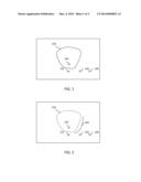 IN SITU COMBUSTION FOR STEAM RECOVERY INFILL diagram and image