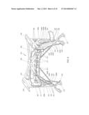 SUPPORT STRUCTURE FOR A VEHICLE WHEEL SUSPENSION diagram and image