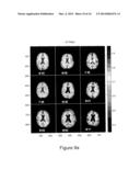 MRI DETECTION OF TISSUE MACROMOLECULAR CHARACTERISTICS USING MTC EFFECTS diagram and image