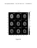 MRI DETECTION OF TISSUE MACROMOLECULAR CHARACTERISTICS USING MTC EFFECTS diagram and image