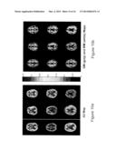 MRI DETECTION OF TISSUE MACROMOLECULAR CHARACTERISTICS USING MTC EFFECTS diagram and image