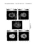 MRI DETECTION OF TISSUE MACROMOLECULAR CHARACTERISTICS USING MTC EFFECTS diagram and image