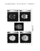 MRI DETECTION OF TISSUE MACROMOLECULAR CHARACTERISTICS USING MTC EFFECTS diagram and image