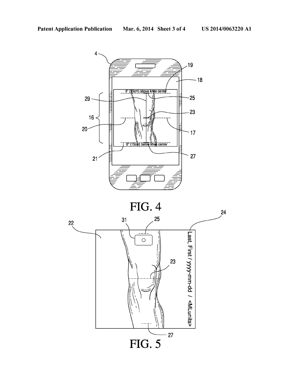 Method and Device for Ordering a Custom Orthopedic Device - diagram, schematic, and image 04