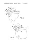 EYEWEAR HAVING MULTIPLE VENTILATION STATES diagram and image