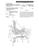 REMOVABLE ATTACHMENT OF A PASSIVE TRANSCUTANEOUS BONE CONDUCTION DEVICE     WITH LIMITED SKIN DEFORMATION diagram and image