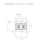 REMOVABLE ATTACHMENT OF A PASSIVE TRANSCUTANEOUS BONE CONDUCTION DEVICE     WITH LIMITED SKIN DEFORMATION diagram and image