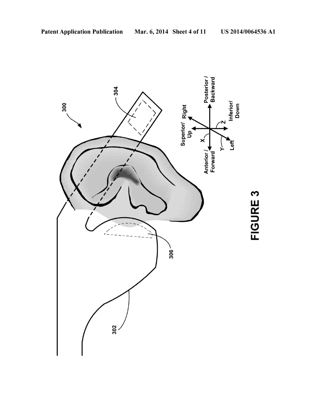 Thin Film Bone-Conduction Transducer for a Wearable Computing System - diagram, schematic, and image 05