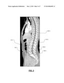 Analytic Morphomics: High Speed Medical Image Automated Analysis Method diagram and image