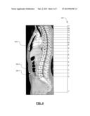 Analytic Morphomics: High Speed Medical Image Automated Analysis Method diagram and image