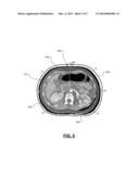 Analytic Morphomics: High Speed Medical Image Automated Analysis Method diagram and image