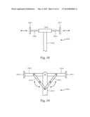 Systems and Methods for Securing Mobile Medical Equipment Supporter     Systems to Patient Transporters with Adjustability diagram and image