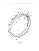 Turbine Engine Transmission Gutter diagram and image