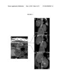 RADIOPAQUE IODINATED PRODUCTS INTENDED FOR USE MEDICAL IMAGING AND THEIR     METHODS diagram and image