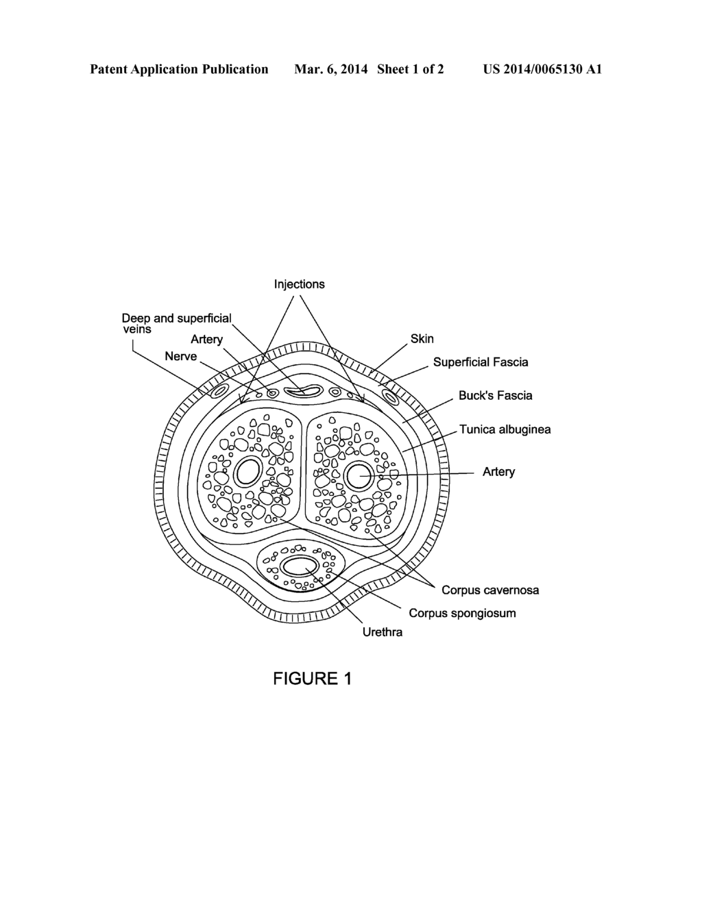 METHOD FOR TREATING PREMATURE EJACULATION WITH A NEUROTOXIN - diagram, schematic, and image 02