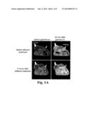 Induction of Tumor Hypoxia for Cancer Therapy diagram and image