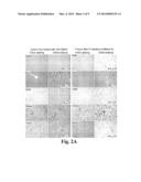 Induction of Tumor Hypoxia for Cancer Therapy diagram and image