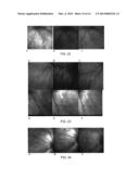 THERMO-RESPONSIVE HYDROGEL COMPOSITIONS diagram and image