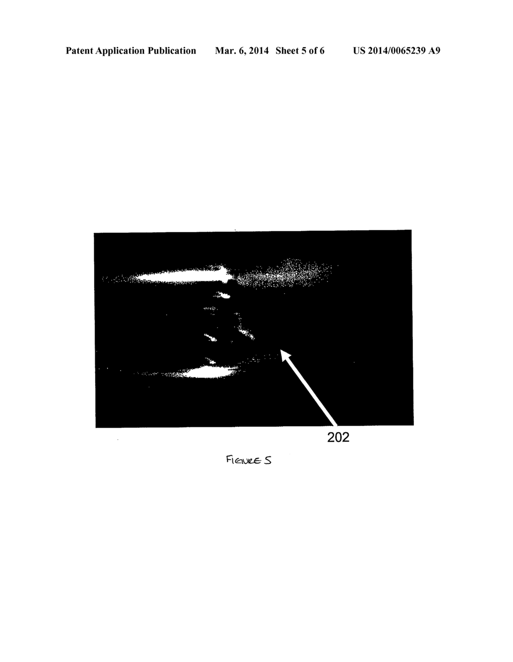 OSTEOINDUCTIVE DEMINERALIZED CANCELLOUS BONE - diagram, schematic, and image 06