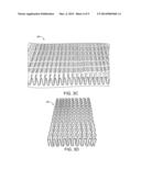 REDOX AND PLATING ELECTRODE SYSTEMS FOR AN ALL-IRON HYBRID FLOW BATTERY diagram and image