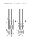 COMPRESSIBLE FUEL CELL SUBGASKET WITH INTEGRATED SEAL diagram and image