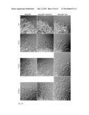 ALTERNATIVELY SPLICED mRNA ISOFORMS AS PROGNOSTIC INDICATORS FOR     METASTATIC CANCER diagram and image