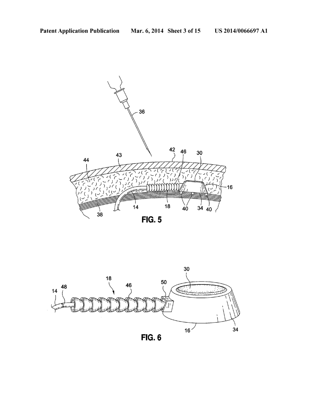 IMPLANTABLE DEVICE TO PROTECT TUBING FROM PUNCTURE - diagram, schematic, and image 04