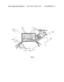 METHOD FOR MINIMALLY INVASIVE SURGERY STEROSCOPIC VISUALIZATION diagram and image