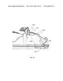 METHOD FOR MINIMALLY INVASIVE SURGERY STEROSCOPIC VISUALIZATION diagram and image