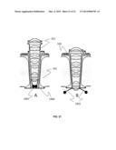 METHOD FOR MINIMALLY INVASIVE SURGERY STEROSCOPIC VISUALIZATION diagram and image