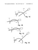 LAPAROSCOPE SYSTEM diagram and image