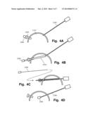 LAPAROSCOPE SYSTEM diagram and image