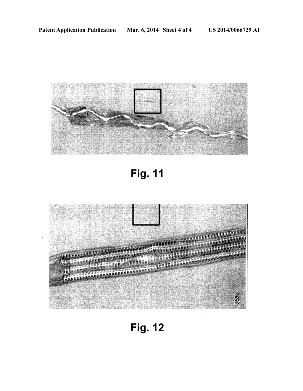 Sampling Device And System For Capturing Biological Targets Of A Body     Fluid, And Process For Manufacturing This Device - diagram, schematic, and image 05