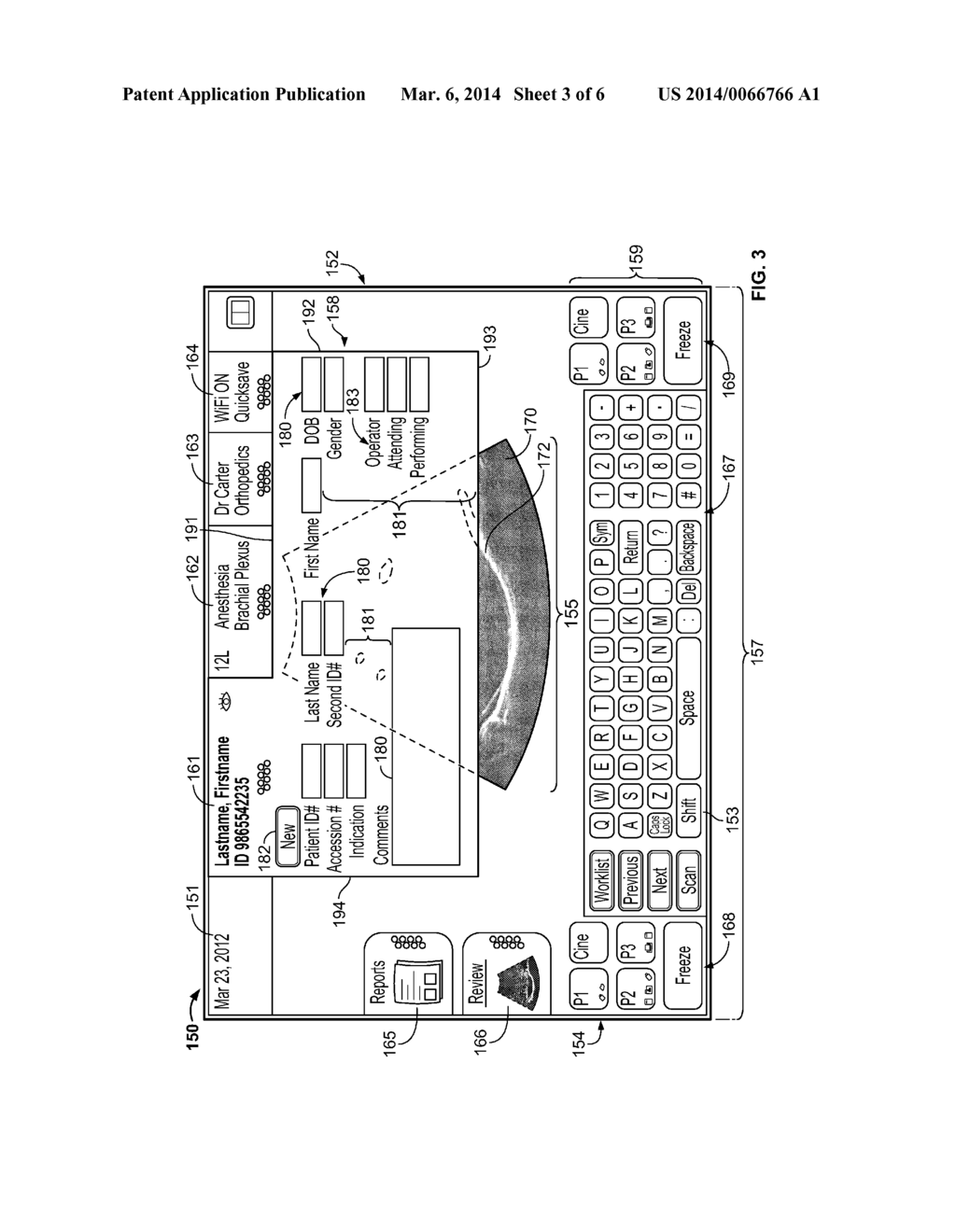 SYSTEMS AND METHODS FOR AN ULTRASOUND WORKFLOW - diagram, schematic, and image 04