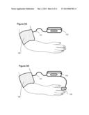 Method and Apparatus For Improved Wound Healing and Enhancement of     Rehabilitation diagram and image