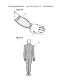 Method and Apparatus For Improved Wound Healing and Enhancement of     Rehabilitation diagram and image