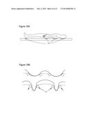 Method and Apparatus For Improved Wound Healing and Enhancement of     Rehabilitation diagram and image