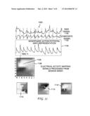 SYSTEM AND METHOD FOR RECONSTRUCTING CARDIAC ACTIVATION INFORMATION diagram and image